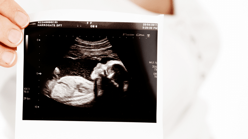 holding baby scan