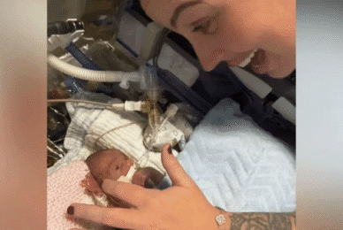Preemie mum: ‘He came out crying, although he looked like a little mouse’