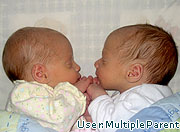 Baby twins die after abortion blunder