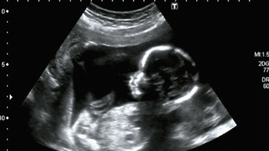 4 week baby scan