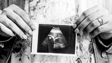 Baby scan