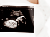 We should expect activists to try to hijack the Crime and Policing Bill for abortion on demand