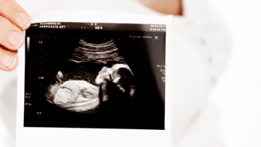 Baby scan