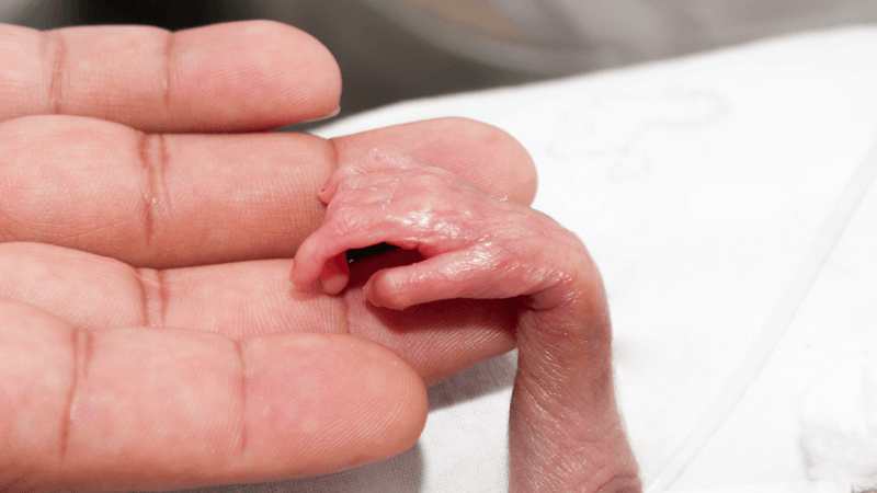 world record for smallest baby