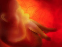PSNI rejects complaints against unborn baby posters