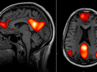 Cannabis accelerates brain ageing, major study reveals