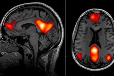 Man in ‘permanent’ vegetative state responds to treatment