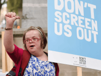 1,600 urge PM to protect Down’s syndrome babies from abortion in NI