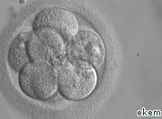 US judge halts federal funding of embryo research