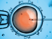 Researchers push for IVF Down’s syndrome screening on NHS