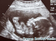 US abortion clinic worker admits to murdering baby