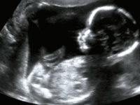 US businesses may have profited from aborted babies’ body parts