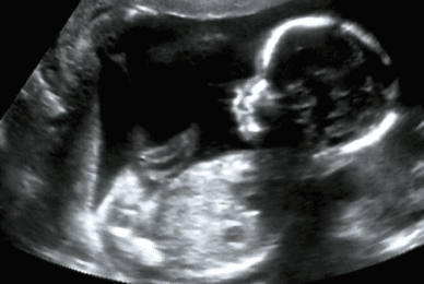 US businesses may have profited from aborted babies’ body parts
