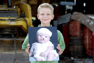 MPs to introduce Bill to stop abortion for cleft lip and club foot